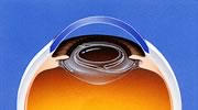 眼内レンズの固定